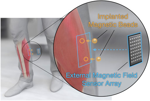 Understanding Biocompatibility: Permanent Magnets in Medical Devices - Part 1