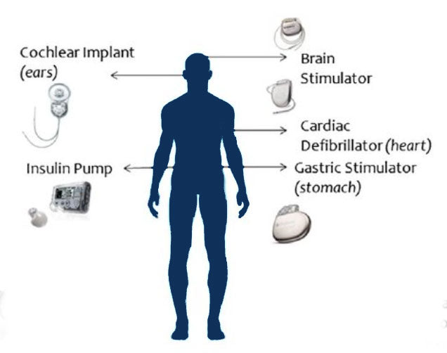 Design Considerations for Permanent Magnet Selection in Medical Devices - Part 2